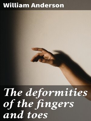 cover image of The deformities of the fingers and toes